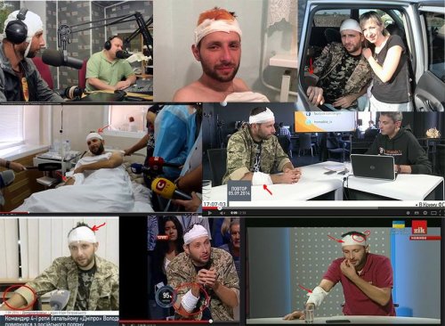 Украинские пропагандисты перебинтовали "российскому спецназовцу" не ту руку