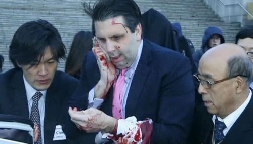 Посол США в Южной Корее получил серьезное ранение